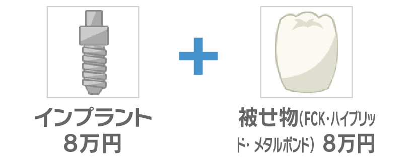 インプラント8万円＋被せ物(FCK・ハイブリッド・メタルボンド)8万円