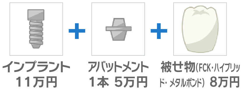 インプラント11万円＋アッパトメント1本5万円＋被せ物(FCK・ハイブリッド・メタルボンド)8万円