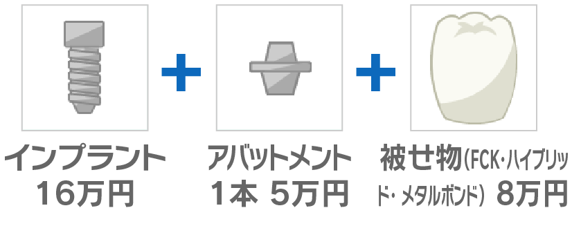 インプラント16万円＋アッパトメント1本5万円＋被せ物(FCK・ハイブリッド・メタルボンド)8万円