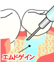 エムドゲイン概念図