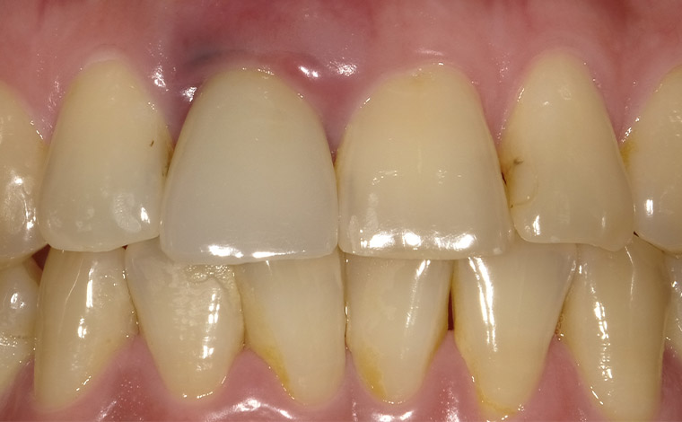 Before Image