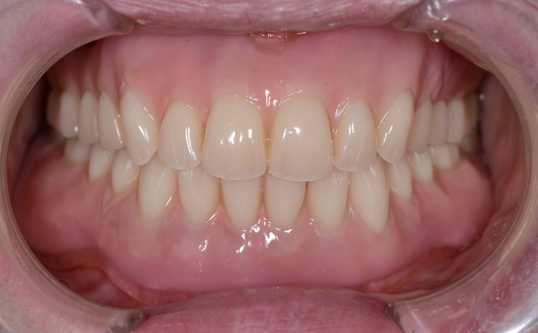 After Image