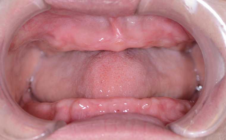 Before Image