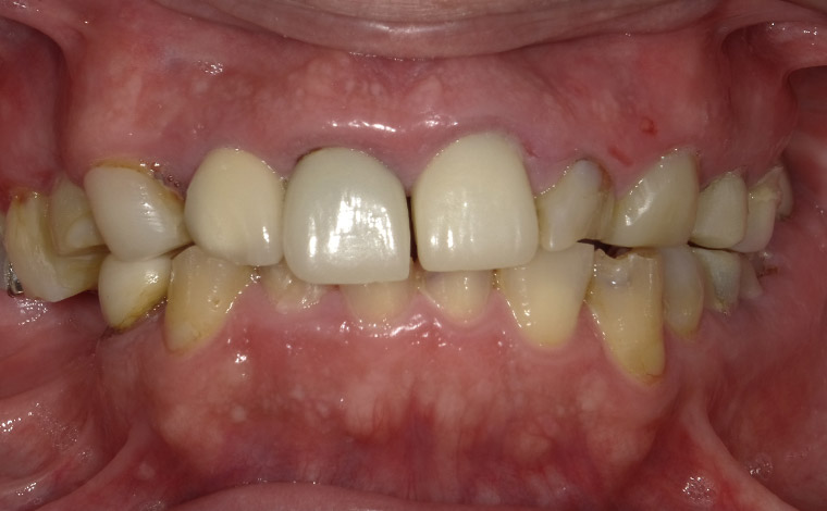 Before Image