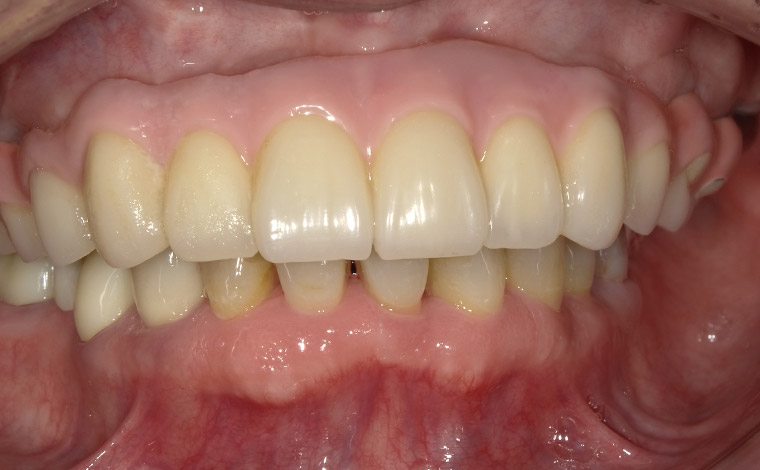 After Image