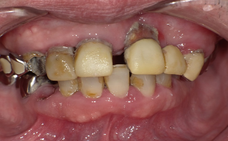 Before Image