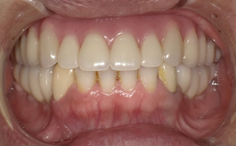 After Image