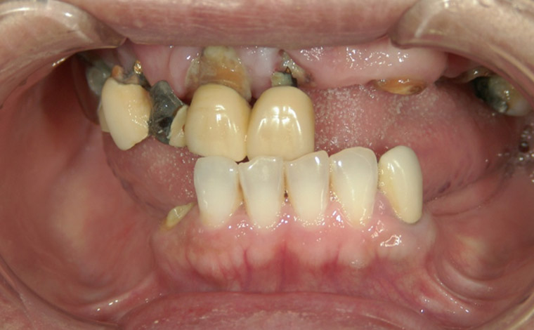 Before Image